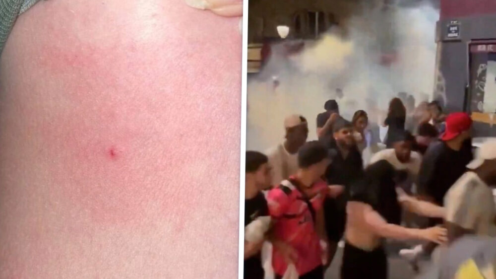 145 Franse festivalgangers zeggen geprikt te zijn met een naald