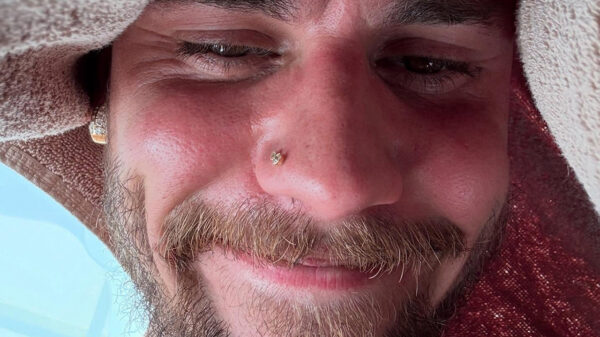 Fans maken zich zorgen om Justin Bieber na 'detox'-selfie vol zweet