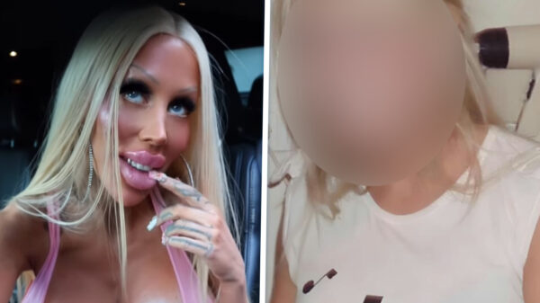 Deense barbiepop laat zien hoe ze eruit zag vóór haar 288K transformatie