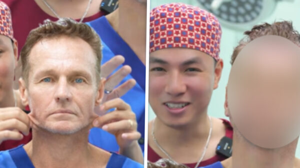 Dankzij deze Vietnamese plastische chirurgie zie je er 30 jaar jonger uit