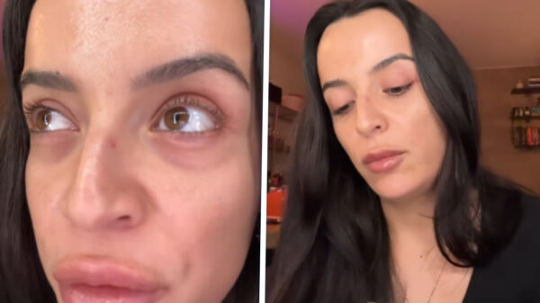 Influencer leert vrouwelijke volgers hoe ze hun belager kunnen verminken