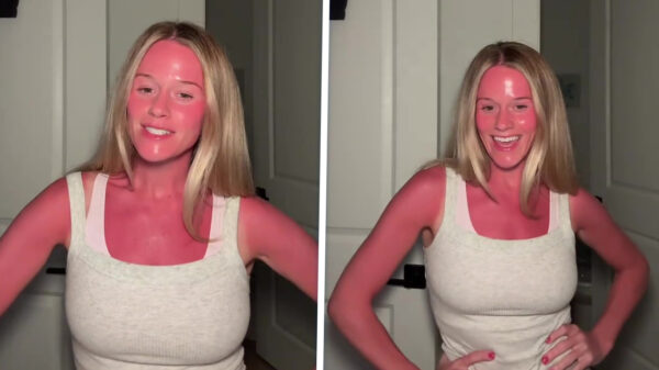 Anna is naar het strand geweest en heeft een lekker kleurtje gepakt