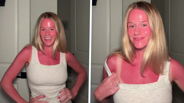 Anna is naar het strand geweest en heeft een lekker kleurtje gepakt