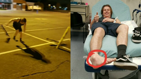 Zelfoverschattende skater breekt enkel tijdens sprong