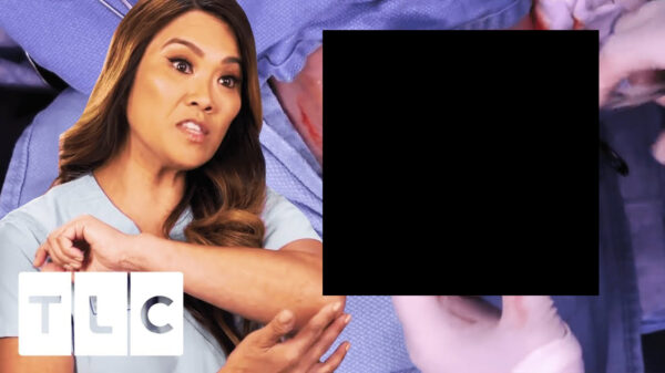 Dr. Pimple Popper gaat vandaag los op de goedaardige gezwellen