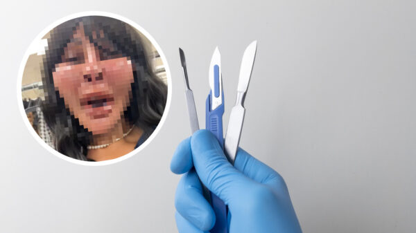 Vrouw laat aan haar gezicht sleutelen en lijkt nu op figurant in spookhuis