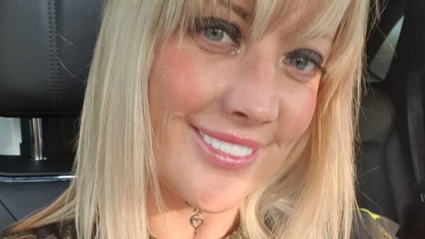 Britse vrouw zwaar verminkt na goedkoop tandartsbezoekje in Turkije