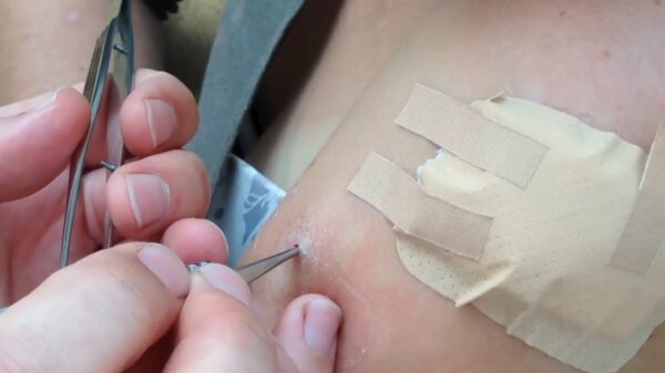 Vrouw neemt per ongeluk wat souveniers mee van haar tropische vakantie