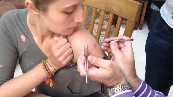 Vrouw neemt per ongeluk wat souveniers mee van haar tropische vakantie