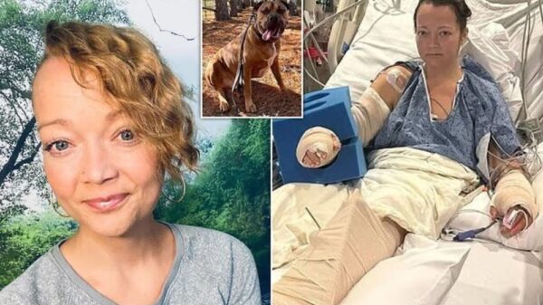 Vrouw uit Tennessee verliest been na aanval door haar eigen pitbull