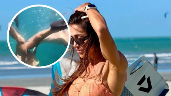 Snorkeltrip eindigt gruwelijk als een verpleeghaai vrouw in haar dij bijt