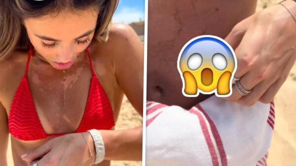 Waarom je beter niet te lang moet knikkebollen in de Australische zon