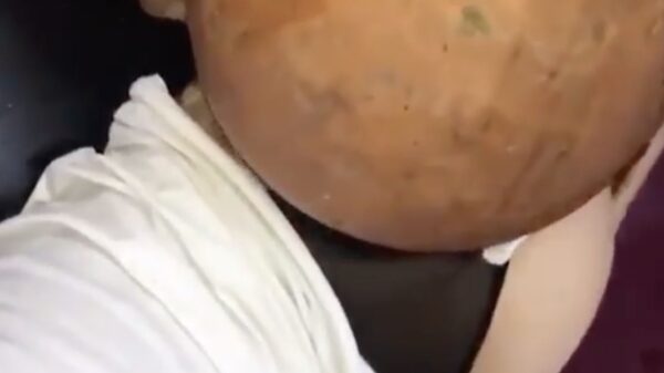 Een bilvergroting kan prima terwijl je het diner staat voor te bereiden