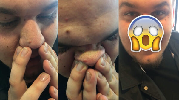 Dankzij deze techniek ben je in één keer van je mee-eters af!