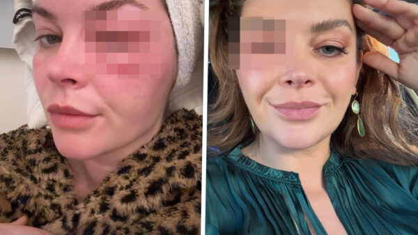 Volgers Miljuschka schrikken zich rot: "Wat is er met haar gezicht gebeurd?"