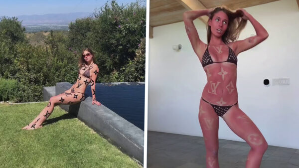 Influencer Anna Malygon wil graag Louis Vuitton tanlines (en huidkanker)