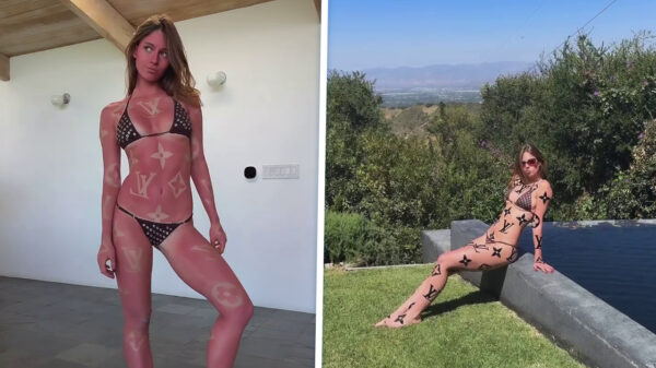 Influencer Anna Malygon wil graag Louis Vuitton tanlines (en huidkanker)