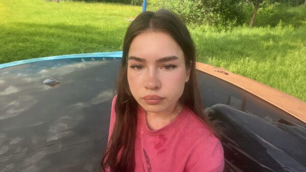 Daarom moet je dus nooit te enthousiast op een trampoline springen