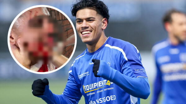 GVVV ontslaat beide trainers na klap die speler zeven tanden kost