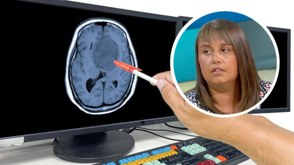 Bizar: Vrouw krijgt 11 jaar (!) chemotherapie voor kanker die ze nooit had