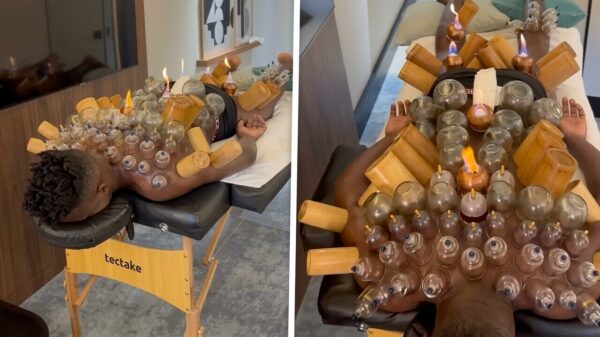 Voormalig Ajax-doelman André Onana ondergaat extreme cuppingtherapie