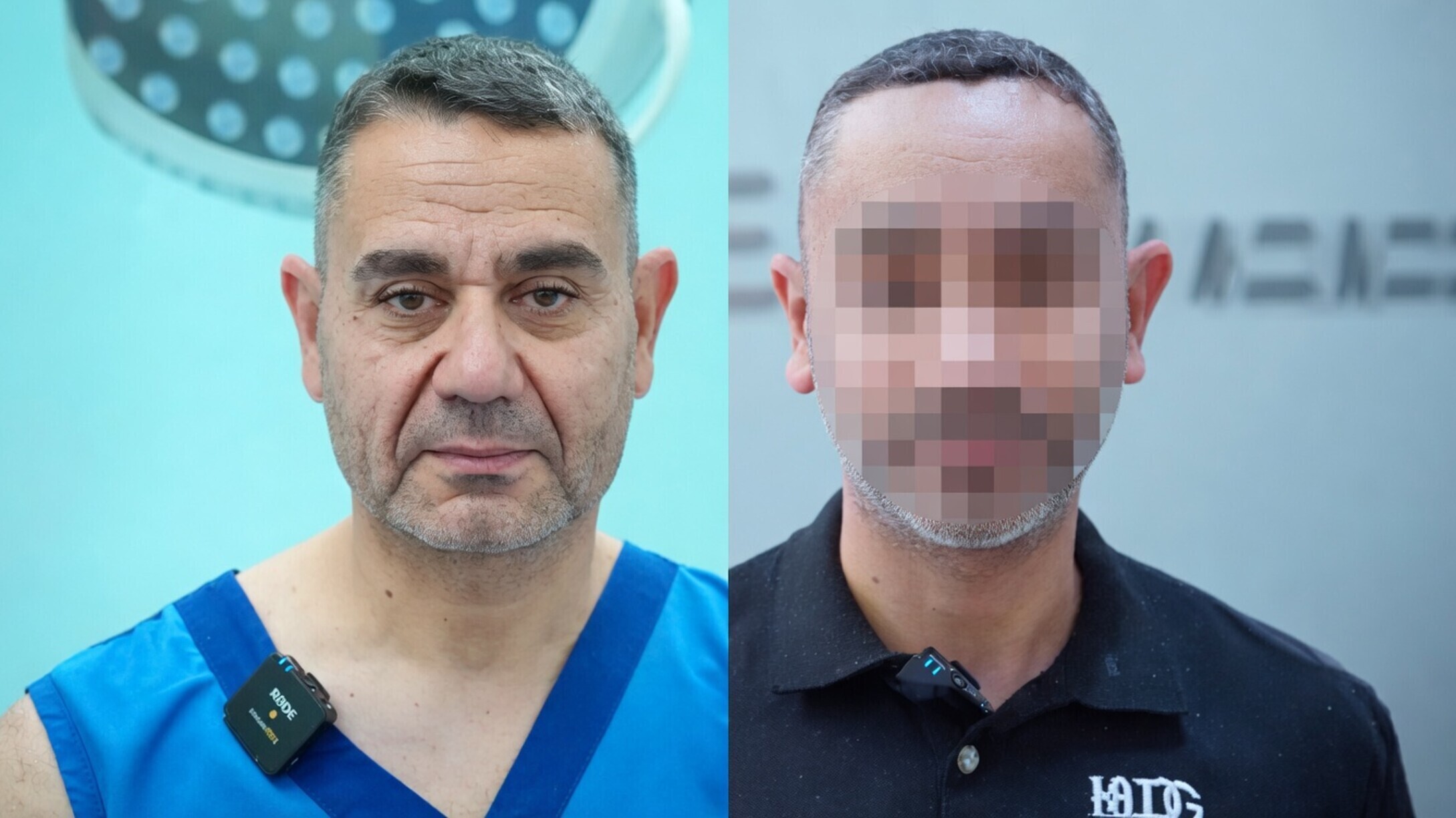 Turkse man (58) gaat onder het mes en ziet er ineens 25 jaar jonger uit!
