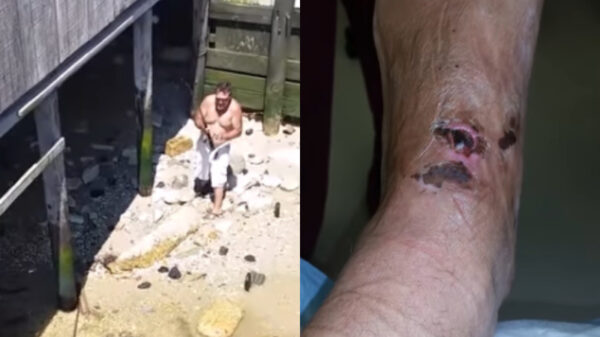 Dit gebeurt er als je wordt gestoken door een pijlstaartrog