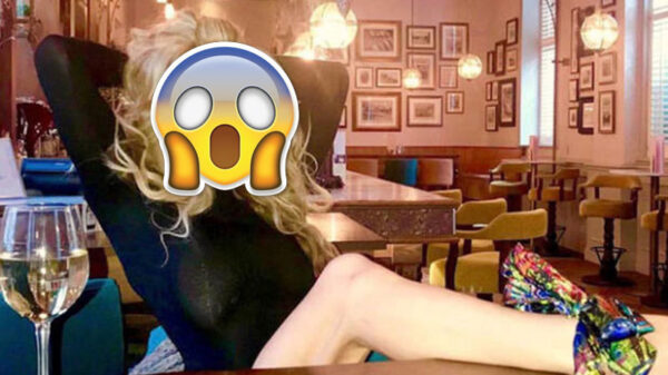 21 voorbeelden waaruit blijkt dat plastische chirurgie niet altijd een verbetering is