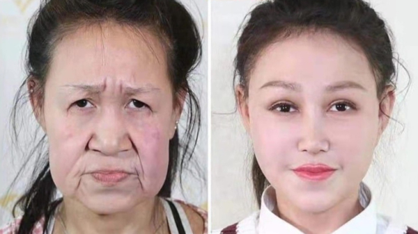 Chinees meisje van 15 krijgt nieuw gezicht nadat mysterieuze aandoening haar op een oma doet lijken