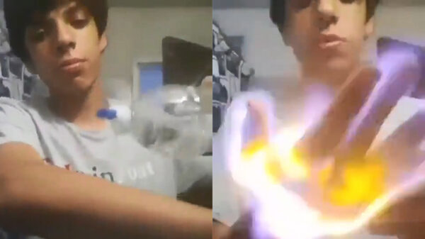 Nominatie voor de Darwin-award gaat vandaag naar 't stoertje dat zijn arm in de fik zet