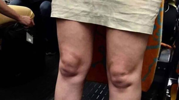 Ligt het aan ons of zie jij ook gezichten in deze random objecten?