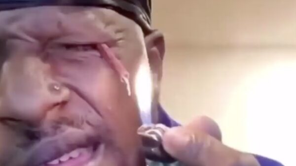 Ja joh, druk anders ff wat vuurwerk onder je ooglid