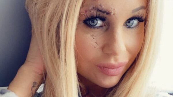 Oh noes, de wonden in Barbies gezicht zijn gaan ontsteken