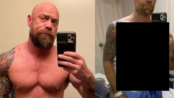 Dit is wat 6 weken ziekenhuisopname door COVID-19 met je lichaam doet