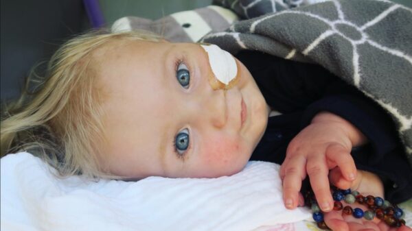 Skoften crowdfund-tip: help Jayme overleven en doneer voor zijn strijd tegen SMA