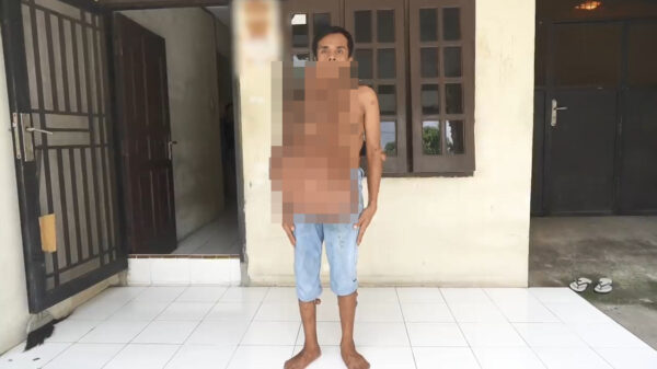 Indonesische pechvogel leeft met 30 kilo aan tumoren op zijn lichaam