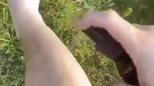 Denk eraan: smeer je goed in met dit warme weer