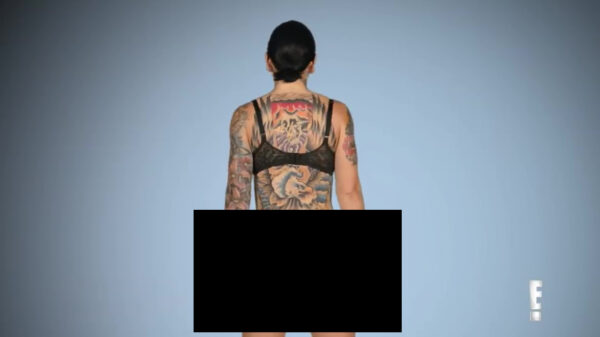 Stripper laat haar compleet verruïneerde billen zien na mislukte operatie