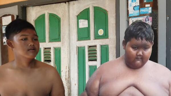 Voormalig zwaarste koter ter wereld krijgt operatie om overtollige huid te verwijderen