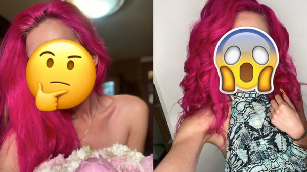 Roze Oekraïense is de 'koningin' van de plastische chirurgie