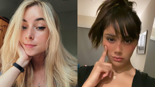 Charmante spetters met sproetjes zijn gewoon woest aantrekkelijk