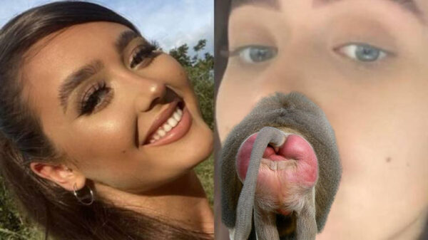 Stewardess Olivia McCann heeft een slechte ervaring als het om lipfillers gaat