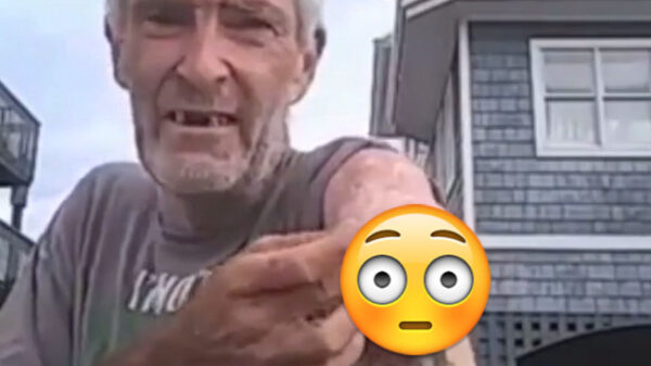 Dr. Pimple Popper zet haar gereedschap in een XXXL-cyste