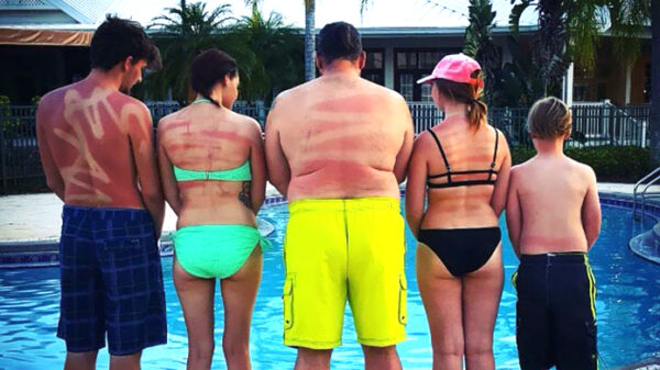 28 redenen om je extra in te smeren als de zon keihard schijnt