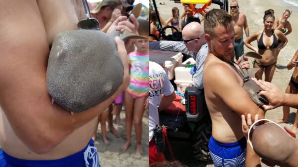 Jonge verpleegsterhaai bijt zich vast in de de arm van een strandganger